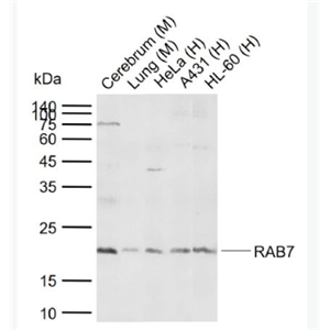 Anti-RAB7A antibody -RAS癌基因相关蛋白RAB7抗体