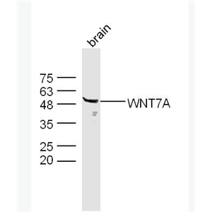 Anti-WNT7A antibody -原癌基因wnt7a蛋白抗体