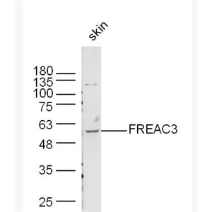 Anti-FREAC3 antibody -叉头相关转录因子3/FOXC1抗体