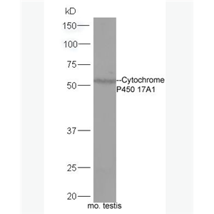 Anti-Cytochrome P450 17A1 antibody -细胞色素C P450 17A1抗体