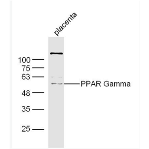 Anti-PPAR Gamma antibody -过氧化酶活化增生受体γ抗体,PPAR Gamma