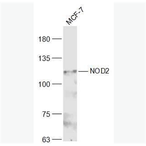 Anti-CARD15/NOD2 antibody -凋亡加强结构域蛋白15抗体