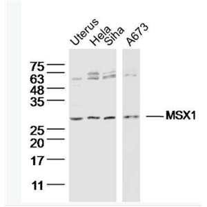 Anti-MSX1 antibody -MSH同源蛋白1样蛋白抗体,MSX1