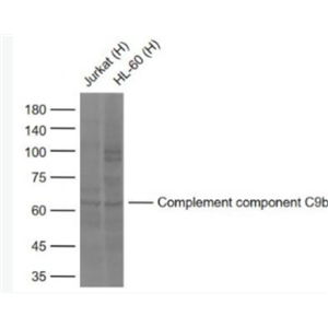 Anti-Complement component C9b antibody -补体C9b抗体,Complement component C9b