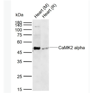 Anti-CaMK2 alpha antibody -钙/钙调素依赖蛋白激酶2α抗体,CaMK2 alpha