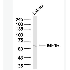 Anti-IGF1R antibody -胰岛素样生长因子1受体抗体