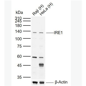 Anti-IRE1 antibody -内质网核信号转导蛋白a1抗体