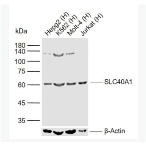 Anti-SLC40A1 antibody -细胞膜铁转运蛋白FP1抗体
