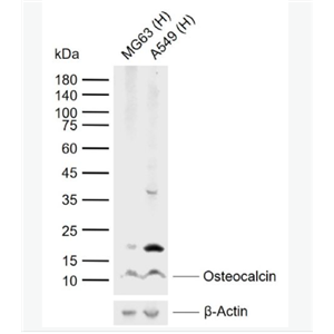Anti-Osteocalcin antibody -骨钙蛋白/骨钙素抗体