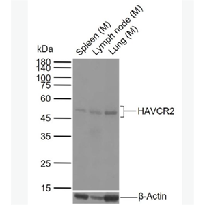 Anti-HAVCR2/TIM-3 antibody -T淋巴细胞膜蛋白3(CD366)抗体