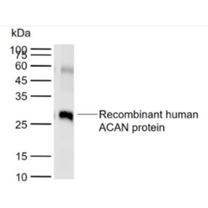 Anti-ACAN antibody -软骨蛋白聚糖抗体