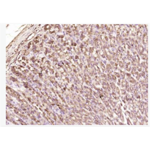 Anti-KGFantibody -纤维母细胞生长因子7抗体