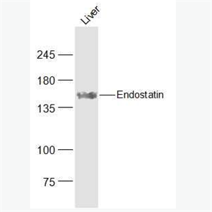 Anti-Endostatin antibody -内皮抑素/内皮他丁抗体