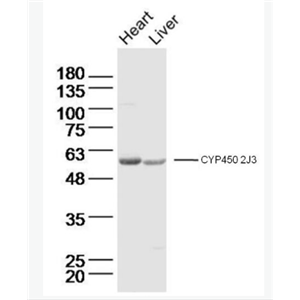 Anti-Cyp2J3 antibody -细胞色素P450 2J3抗体,Cyp2J3