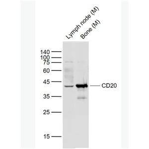 Anti-CD20 antibody -CD20抗体