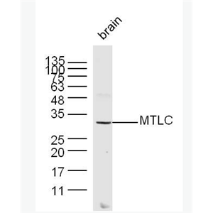 Anti-MTLC antibody -致癌基因抗体