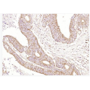 Anti-CEAcam8 antibody -癌胚抗原相关细胞粘附分子8抗体