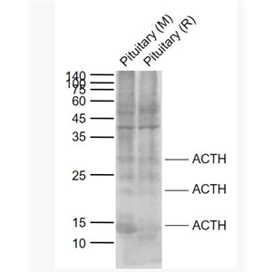 Anti-ACTH (7-23) antibody -促肾上腺皮质激素ACTH (7-23)抗体,ACTH (7-23)