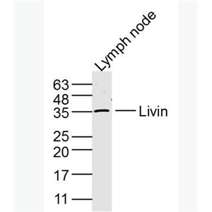Anti-Livin antibody-凋亡抑制蛋白抗体