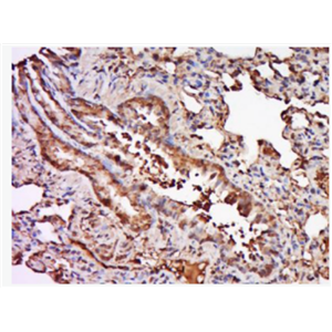 Anti-TRAF6 antibody-肿瘤坏死因子受体相关因子6抗体