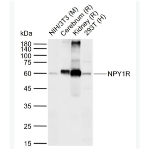 Anti-NPY1R antibody-神经肽Y1受体抗体,NPY1R