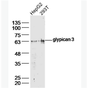 Anti-Glypican 3 antibody-磷脂?；嫉鞍拙厶?3抗體