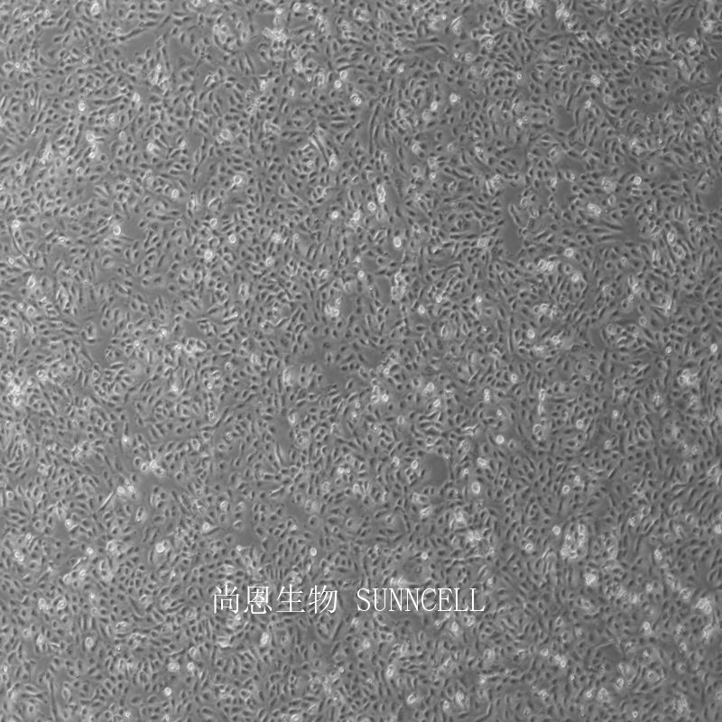 人纤维肉瘤细胞,HT1080