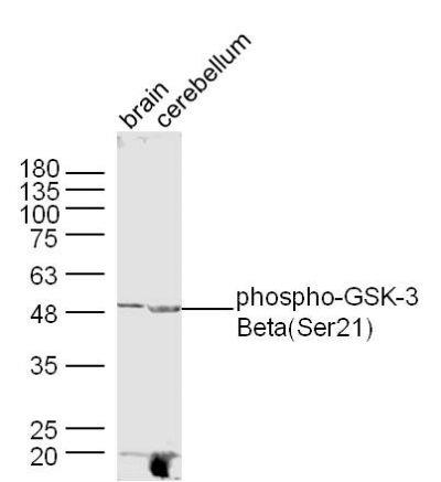 Anti-phospho-GSK-3 Beta (Ser21) antibody-磷酸化糖原合酶激酶3β抗体,phospho-GSK-3 Beta (Ser21)