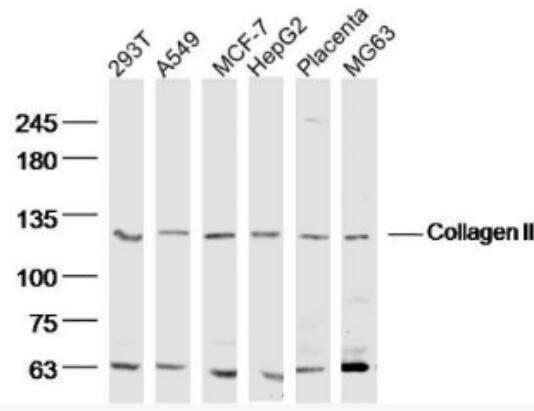 Anti-Collagen II antibody-Ⅱ型胶原α1蛋白/软骨钙素抗体,Collagen II