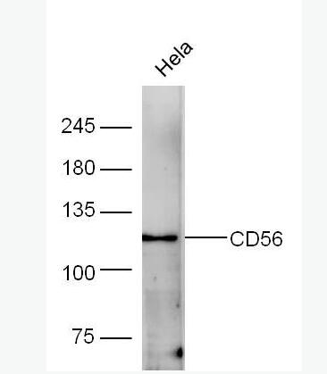 Anti-CD56 antibody-神经细胞粘附分子1抗体,CD56