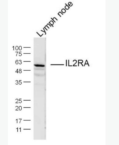 Anti-IL2RA/CD25 antibody-白介素2受体a链/IL-2RA抗体,IL2RA/CD25