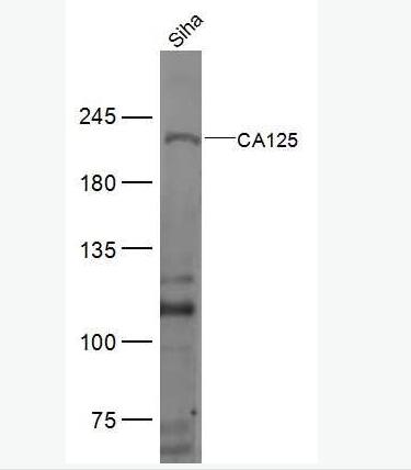 Anti-CA125 antibody-卵巢癌抗原抗体,CA125