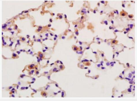 Anti-SFTPA1 antibody-肺表面活性蛋白A抗体,SFTPA1