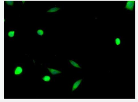 Anti-RAR alpha antibody-維甲酸受體RAR α/RAR α抗體,RAR alpha