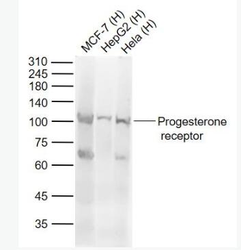 Anti-progesterone receptorantibody-孕激素受體抗體,progesterone receptor