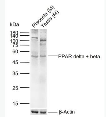 Anti-PPAR delta + beta  antibody-D型-過氧化酶活化增生受體抗體,PPAR delta + beta