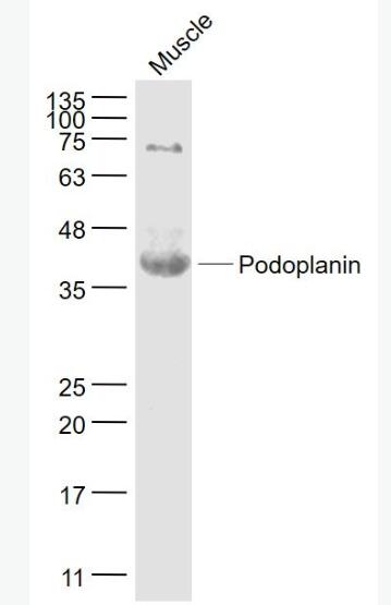 Anti-Podoplanin antibody-平足蛋白/淋巴管內(nèi)皮細(xì)胞蛋白抗體,Podoplanin