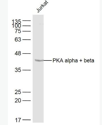 Anti-PKA alpha + beta antibody-蛋白激酶A抗体,PKA alpha + beta