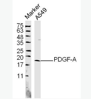 Anti-PDGF-A antibody-血小板源性生长因子A抗体,PDGF-A