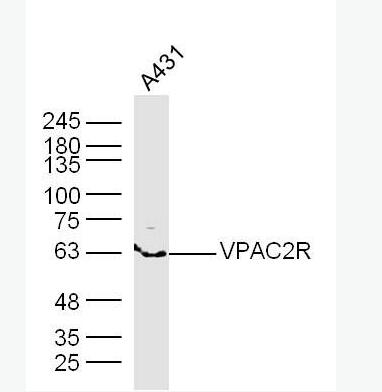 Anti-VPAC2R antibody-腺苷酸環(huán)化酶激活肽受體-II/血管活性腸肽受體-II抗體,VPAC2R