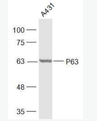 Anti-P63 antibody-肿瘤抑制基因p63α抗体,P63