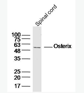 Anti-SP7/Osterix  antibody-成骨相关转录因子抗体,SP7/Osterix