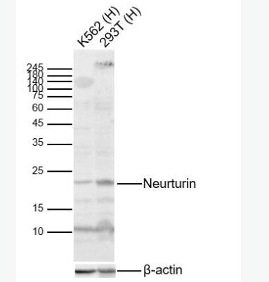 Anti-Neurturin  antibody-神經(jīng)營養(yǎng)因子抗體,Neurturin