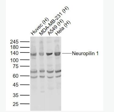 Anti-Neuropilin 1 antibody-神经纤毛蛋白1抗体,Neuropilin 1