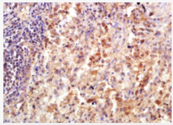 Anti-TIE2 antibody-血管生成素受體2抗體,TIE2