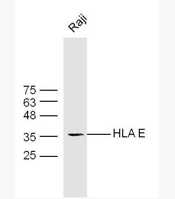 Anti-HLA E antibody-人类白细胞抗原E抗体,HLA E