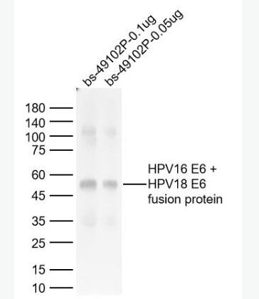 Anti-HPV16 E6 + HPV18 E6 antibody-人类乳头状瘤病毒16/18 E6抗体,HPV16 E6 + HPV18 E6