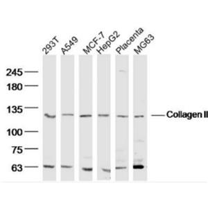 Anti-Collagen II antibody-Ⅱ型胶原α1蛋白/软骨钙素抗体