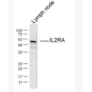 Anti-IL2RA/CD25 antibody-白介素2受体a链/IL-2RA抗体