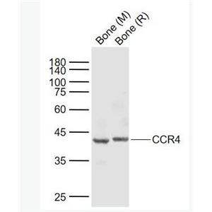 Anti-CCR4 antibody-细胞表面趋化因子受体4抗体,CCR4